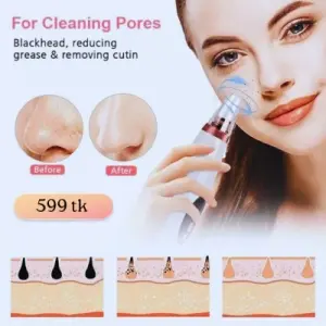 রিচার্জেবল ব্ল্যাকহেড ও হোয়াইটহেড রিমুভার ডিভাইস (পুরুষ ও মহিলাদের জন্য)